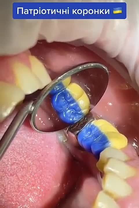 �������� ������ �� ��� �� ���� � � ���� ���� ����� �������, ������� �� �������� 5 ��� �����
